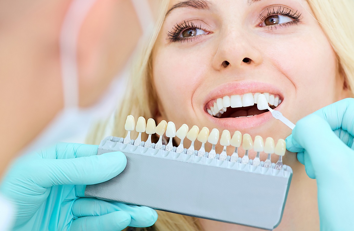 teeth whitening in edmonton