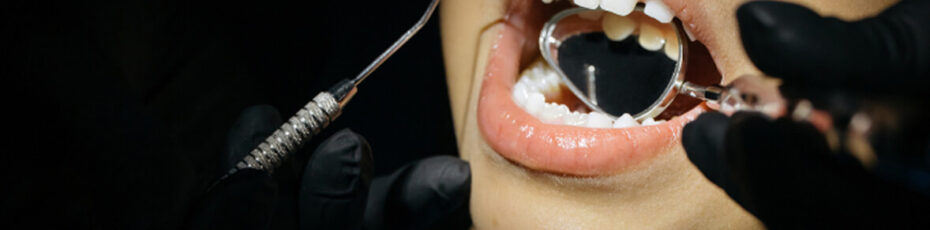 Guided biofilm therapy near you