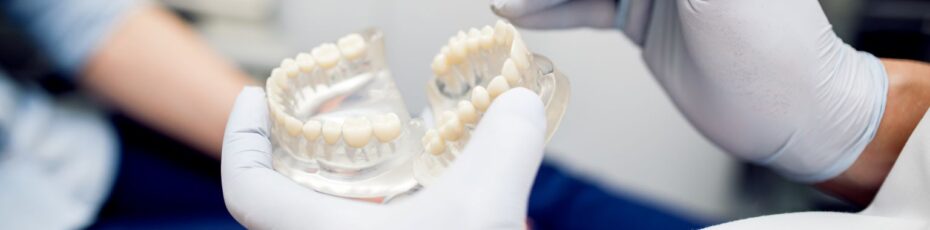 5 Signs Your Dental Bridge Needs Repair or Replacement