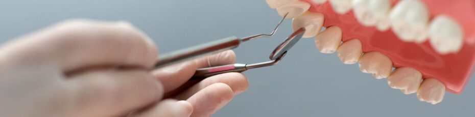 Is a Dental Bridge Painful? What to Expect During and After the Procedure