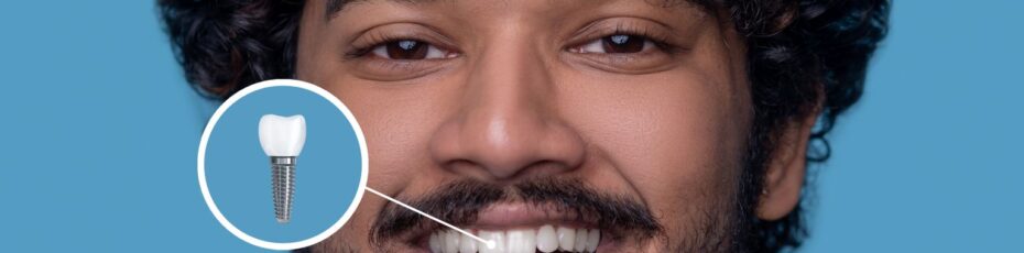 Dental Implants Explained: Process and Benefits